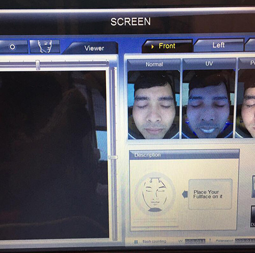 Sửa máy soi da, phân tích da